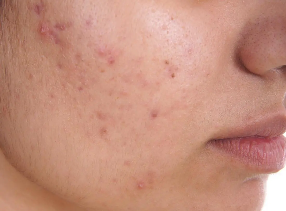 Best Skin Doctor